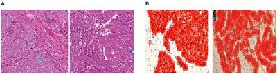 A Robust Training Method for Pathological Cellular Detector via Spatial Loss Calibration